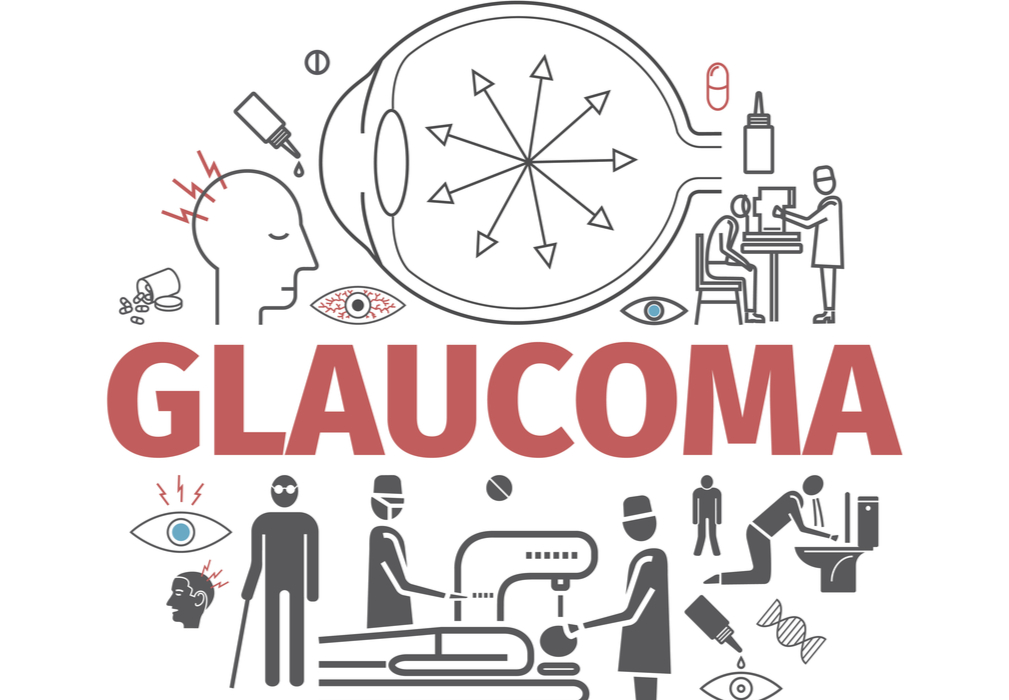 Glaucoma Causes Symptoms and Treatments First Eye Care DFW Keller